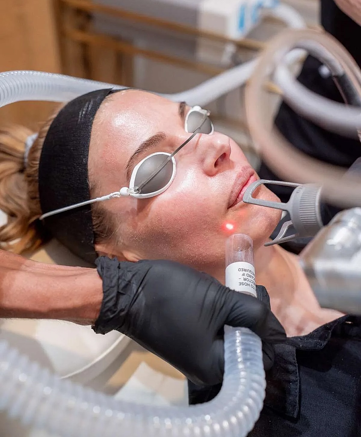 Facial treatment with laser technology in progress.